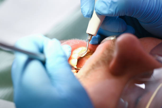 Best Walk-In Emergency Dental Services in Seco Mines, TX